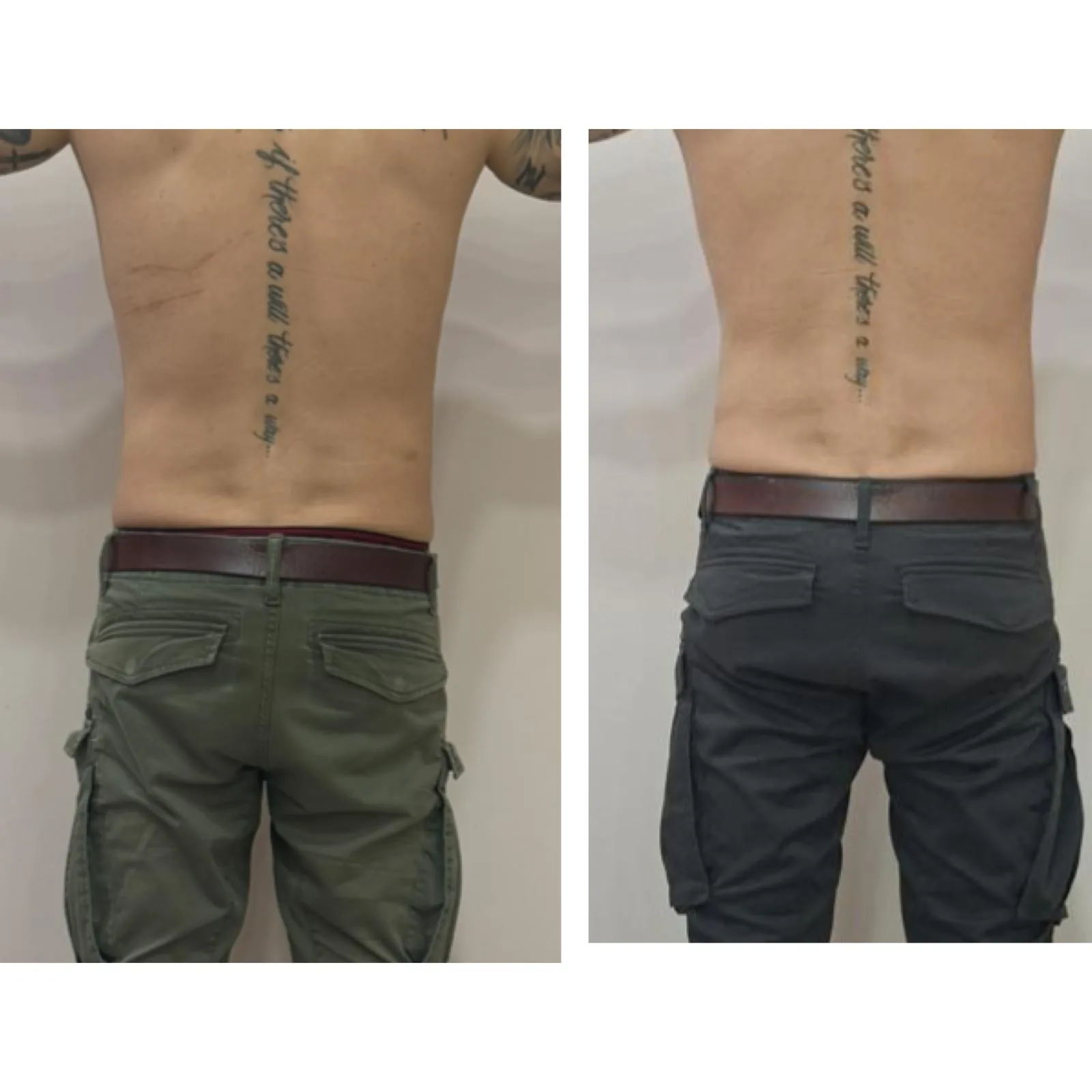 Comparativa aportada por Coimbra: espalda y cintura, vista posterior; antes y después